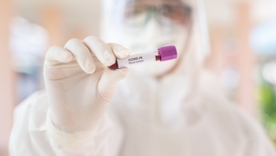 TOFAŞ'ta vaka sayısı 11'e yükseldi